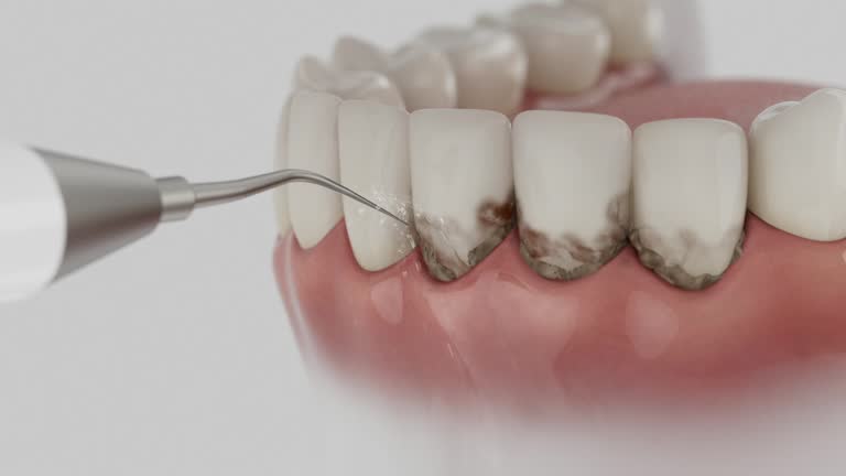 Reliable Root Canal Treatment contractor in Nicholas County County, KY by Dentist Open Now